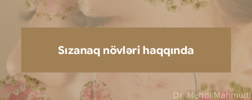 sizanaq novleri haqqinda