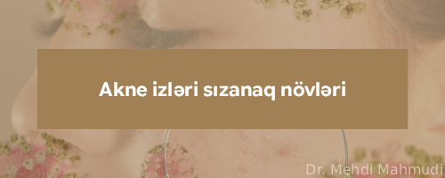 akne izleri sizanaq novleri