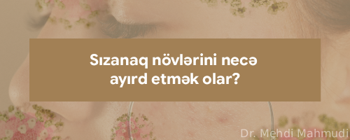 sizanaq novlerini nece ayird etmek olar