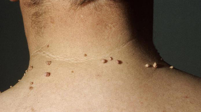 Xallar və onların aradan qaldırılma üsulları / Dermatoloq Hekim Dr Mehdi