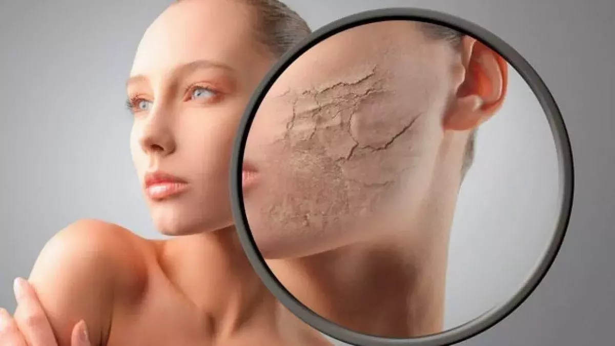 Dermatoloq - KSEROSİZ (QURU DƏRI) NƏDİR? Quru dəri: simptomlar və səbəblər