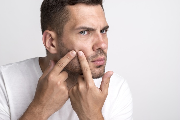 Sızanağın Psixoloji Təsirləri / Dermatoloq Dr.Mehdi Mahmudi