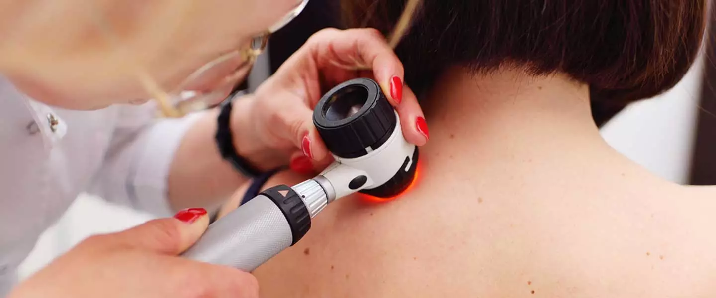 Ziyil / Səbəbləri və Müalicəsi / Dermatoloq - Kosmetoloq / Dr.Mehdi