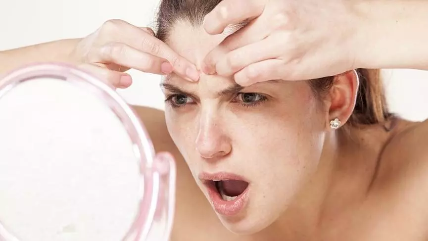 Dermatoloq | Dermatoloq Dr.Mehdi Hekim | Sızanaq Haqqında